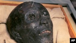 ARSIP – Foto yang diambil tanggal 4 November 2007 menunjukkan wajah mumi Raja Tut yang dibungkus kain linen di peti kacanya yang baru di kuburan bawah tanah di Lembah Para Raja di Luxor, Mesir yang terkenal (foto: AP Photo/Ben Curtis, File)