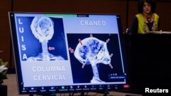 پژوهشگران مکزیکی واقعی بودن مجموعه‌ای از اجساد مومیایی‌شده سه‌انگشتی از پرو را در مقابل کنگره مکزیک تایید کردند - ۱۶ آبان ۱۴۰۲