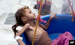 FILE - In this Aug. 25, 2018, image made from video, a severely malnourished girl is weighed at the Aslam Health Center in Hajjah, Yemen.