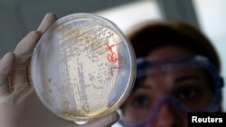 FILE - A laboratory worker looks for strains of E.coli bacteria.