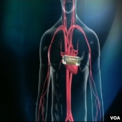 Perubahan gaya hidup dapat meningkatkan kesehatan jantung Anda.