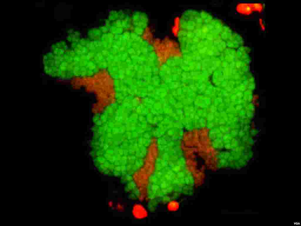 Microscopic image of a group of multi-celled methane-oxidizing microbes found in deep-sea methane seeps in Hydrate Ridge, Oregon. (S. McGlynn, Caltech) 